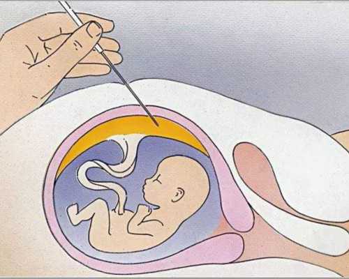 天津那个地方有代孕公司,40岁以后做试管婴儿的成功率有多高_检查染色体主要