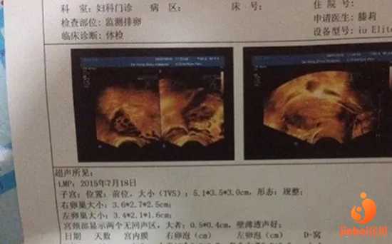 天津供卵专业医院排名_【上海中山医院有供卵试管吗】这次一定好好听话了，